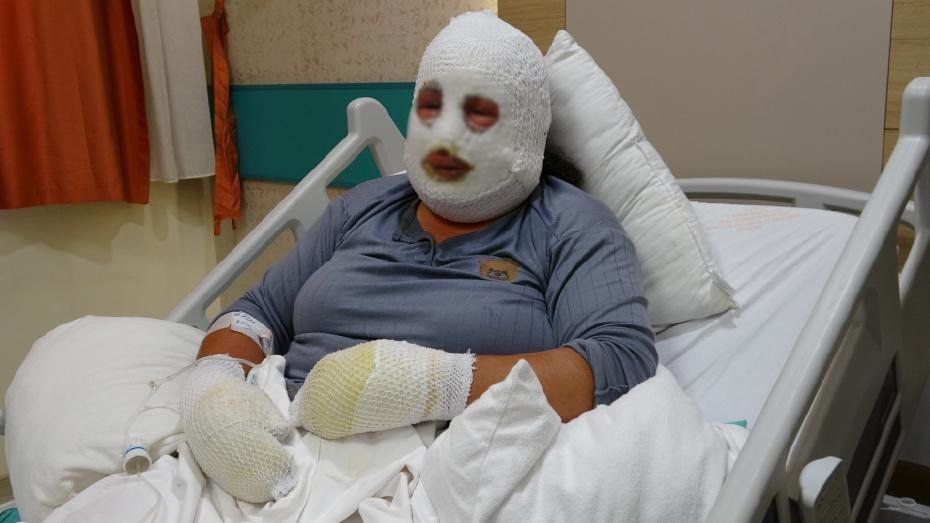 Ardahan'da Ağılda Çıkan Yangında Bir Anne ve Kızının Kurtuluş Hikayesi